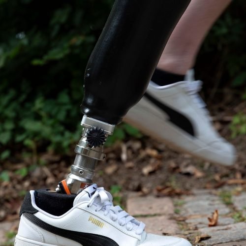 Orthopädietechnik 2